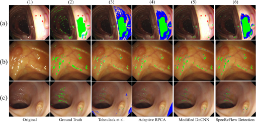 JMI_11_2_024012_f006.png